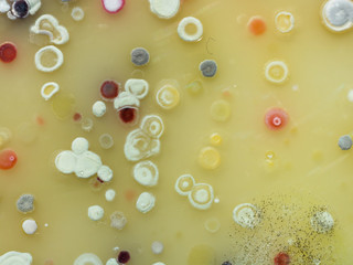 The growth of Actinobacteria cololonies on Cyganow and Žukov's agar plates, with different colony...