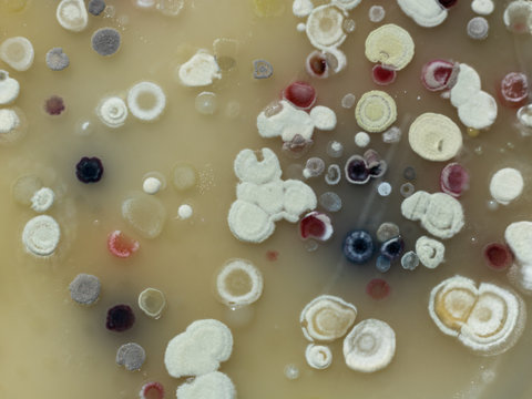 The growth of Actinobacteria cololonies on Cyganow and Žukov's agar plates, with different colony texture and colors.