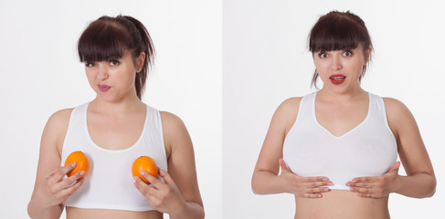 Beautiful girl before and after breast augmentation. Plastic surgery. Beauty of the body.