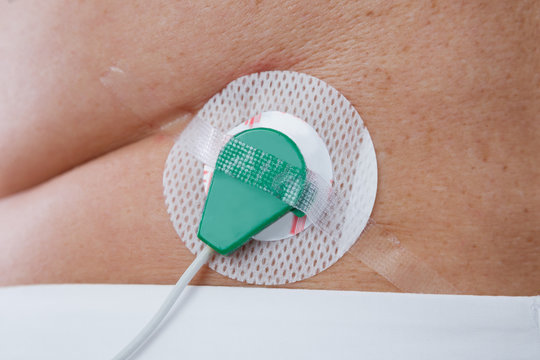 Medical electrode on the human body