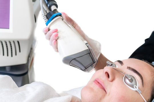 Laser treatment being performed on female patient for face rejuvenation. White background and hand piece showing. Patient wearing eye protection.