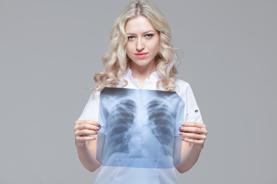 Young female doctor looking at the x-ray picture of lungs