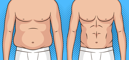 Color vector pop art style illustration of a man before and after weight loss. Flat stomach against the fat belly. Poster about healthy eating and lifestyle. Athletic male figure after weight loss