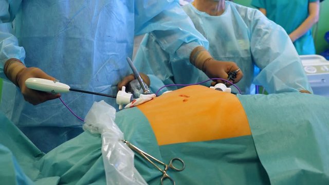 Professional surgeons use medical tools, performing a surgery at a clinic.