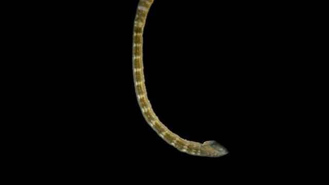 Leech. Fish leech Piscicola under the microscope. A parasite that attaches to fish and sucks blood from them, from the family of annelids. With mass reproduction can cause serious damage to fisheries.