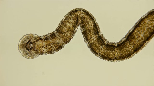Leech. Fish leech Piscicola under the microscope. A parasite that attaches to fish and sucks blood from them, from the family of annelids. With mass reproduction can cause serious damage to fisheries.