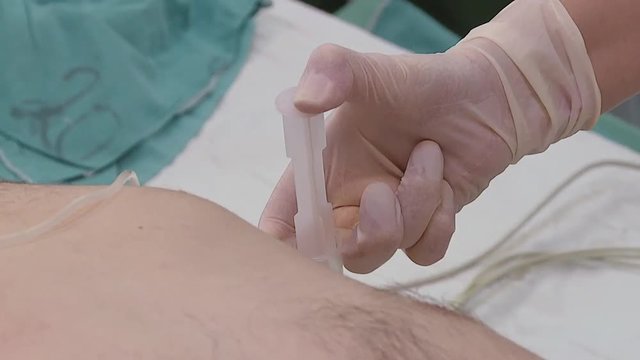 Anesthesiologist or doctor holding needle for intravenous general anesthesia injection. Intravenous administration of a sedative through a catheter mounted on the patient's arm