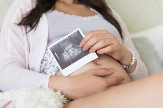 pregnant woman holding her image of baby ultrasound