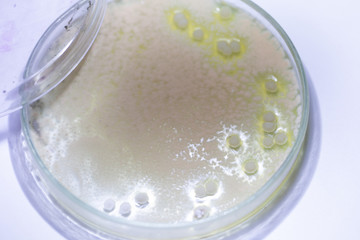 Backgrounds of Characteristics and Different shaped Colony of Bacteria and Mold growing on agar plates from Soil samples for education in Microbiology laboratory.