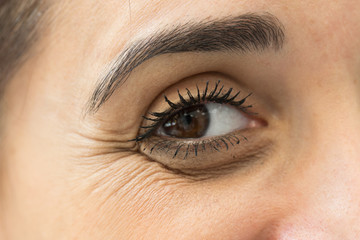 Fototapeta na wymiar A beautiful young woman is seen up close with crow’s feet by her eye. Wrinkled face caused by aging. A common place for fillers and plastic surgery.