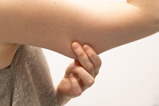 An extreme closeup view of the woman pinching the loose skin beneath her upper arm muscles. Fatty area of the human body. A common place for plastic surgery procedures in women.