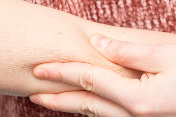 A close up view of a Caucasian person pinching the fat in their arm.