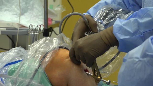 Anterior cruciate ligament reconstruction (ACL reconstruction) is a surgical tissue graft replacement of the anterior cruciate ligament, located in the knee, to restore its function after an injury.