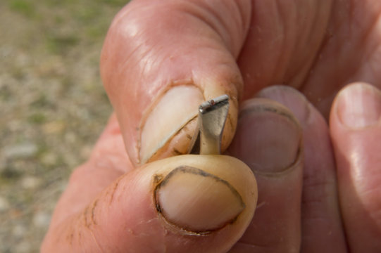 Removing A Tick From A Person