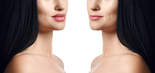 Comparison of female lips before and after  filler injections beauty plastic. Beautiful perfect woman lips with natural makeup