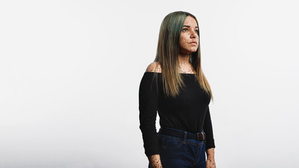 Woman with freckles on body