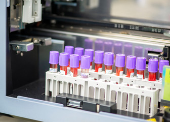 Tubes of blood sample for testing