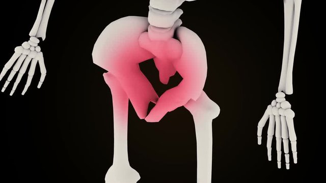 Pelvic pain on a skeleton concept