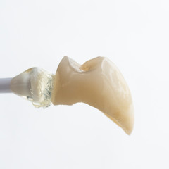 single unit press ceramic crown