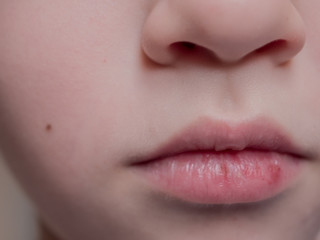 Naklejka premium Beautiful nose and lips of ten year old child close up, 10 y.o. kid