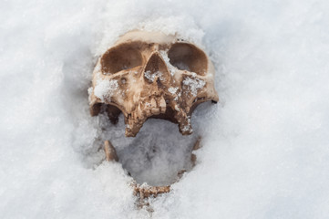  skull covered with snow and ice.  human skull. buried human remains