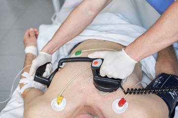 Doctor intensivist performs defibrillation to critical patient - obrazy, fototapety, plakaty