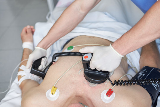 Doctor intensivist performs defibrillation to critical patient