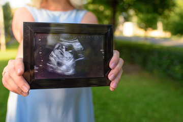 Pregnant woman shows ultrasound on a warm summer day