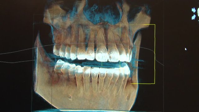 Dentist 3D image
