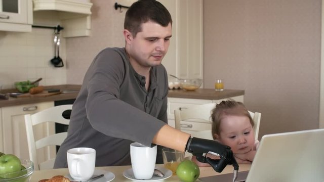 Waist-up shot of 20-something Caucasian father with myoelectric hand prosthesis sitting at breakfast table with 3-yaer-old daughter, typing on laptop, running video and watching it together with her