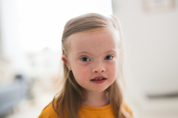 Caucasian child girl blonde with Down syndrome