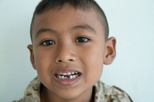 Cute little asian boy smile and show teeth broken