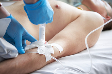 hands in blue latex gloves perfoming intravenous anesthesia by injecting propofol