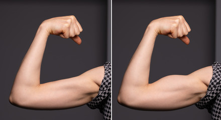 A before and after view on the arm of a young Caucasian woman. Showing toned biceps after spending time at the gym and working out. - obrazy, fototapety, plakaty