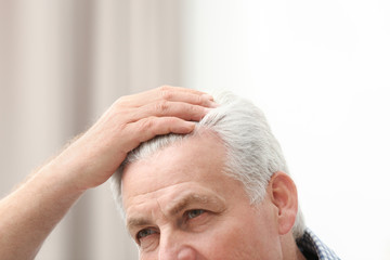 Senior man with hair loss problem indoors, closeup