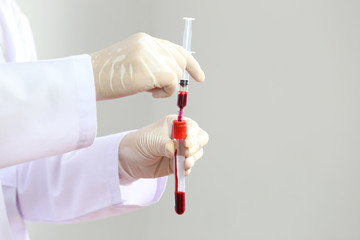 Doctor hand holding blood collection tubes in hematology laboratory, Medicine and science concept