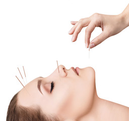 Woman undergoing acupuncture treatment. - obrazy, fototapety, plakaty