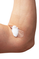 stab from the injection on the hand with cotton