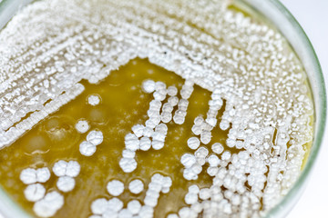 Backgrounds of Characteristics and Different shaped Colony of Bacteria and Mold growing on agar plates from Soil samples for education in Microbiology laboratory.