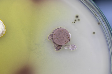 Backgrounds of Characteristics and Different shaped Colony of Bacteria and Mold growing on agar plates from Soil samples for education in Microbiology laboratory.