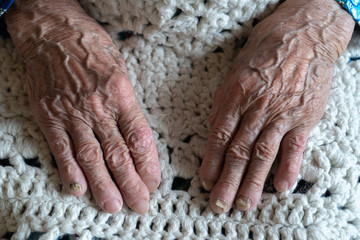 Hands of an old woman 90 years close up.