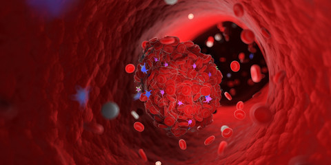 3d rendered medically accurate illustration of a blood clot