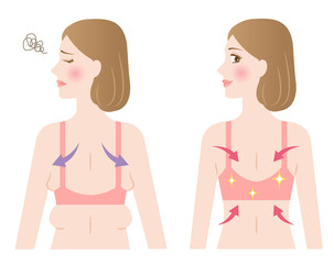 背中　わき肉　ビフォアアフター　女性