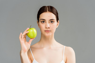 young woman with pimples on face holding green apple isolated on grey