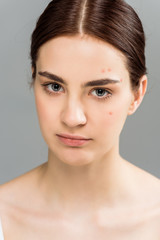 Obraz premium upset young brunette woman with acne on face isolated on grey