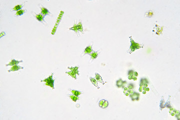 Freshwater aquatic plankton under microscope view.