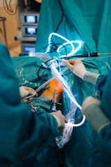 Team of surgeons operating in the hospital