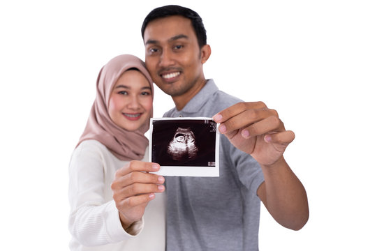ultrasound image of baby hold by couple on camera on isolated background