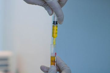 hand in glove holding test tube of blood