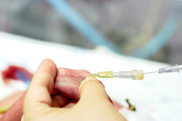 Closeup nurse hands gradually stab injecting medicine from syringe pass IV Catheter at sick newborn baby's hands.
